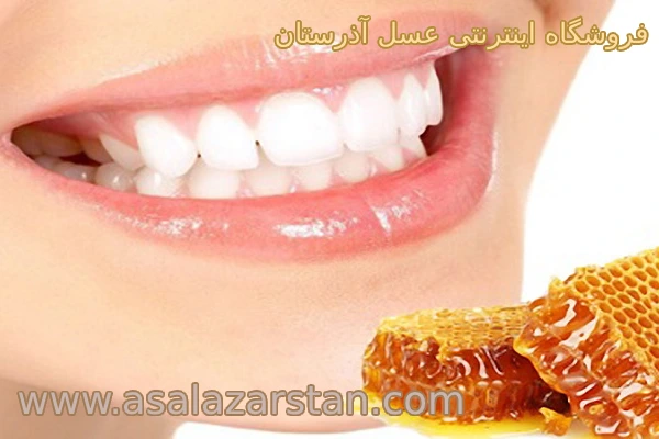 عسل برای عفونت لثه