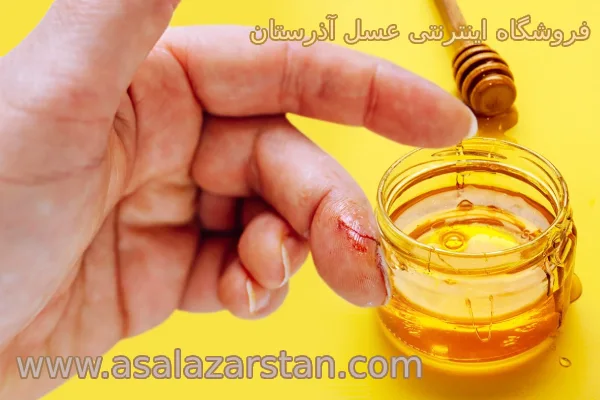 ضدعفونی انواع زخم ها با عسل کوهستان