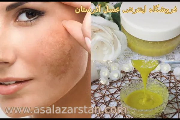 مهمترین خواص ژل رویال برای پوست